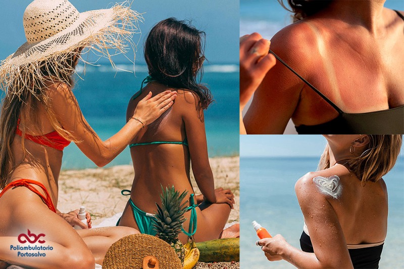 A A Abbronzatissima!